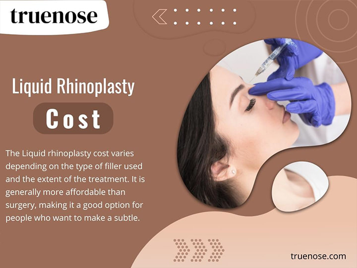 Liquid Rhinoplasty Cost